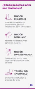 ¿Dónde podemos sufrir una tendinosis? - blog durcal