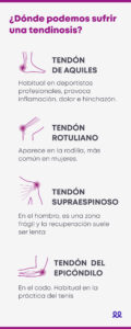 ¿Dónde podemos sufrir una tendinosis? - blog durcal