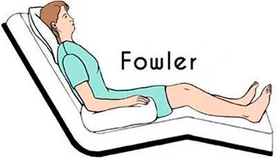 posición fowler 